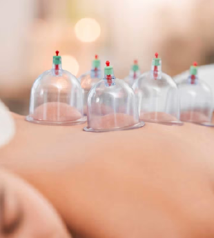 Dry Needling 3